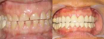 Before and After - Sacred Heart Dental Clinic