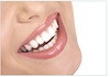 Tooth Whitening